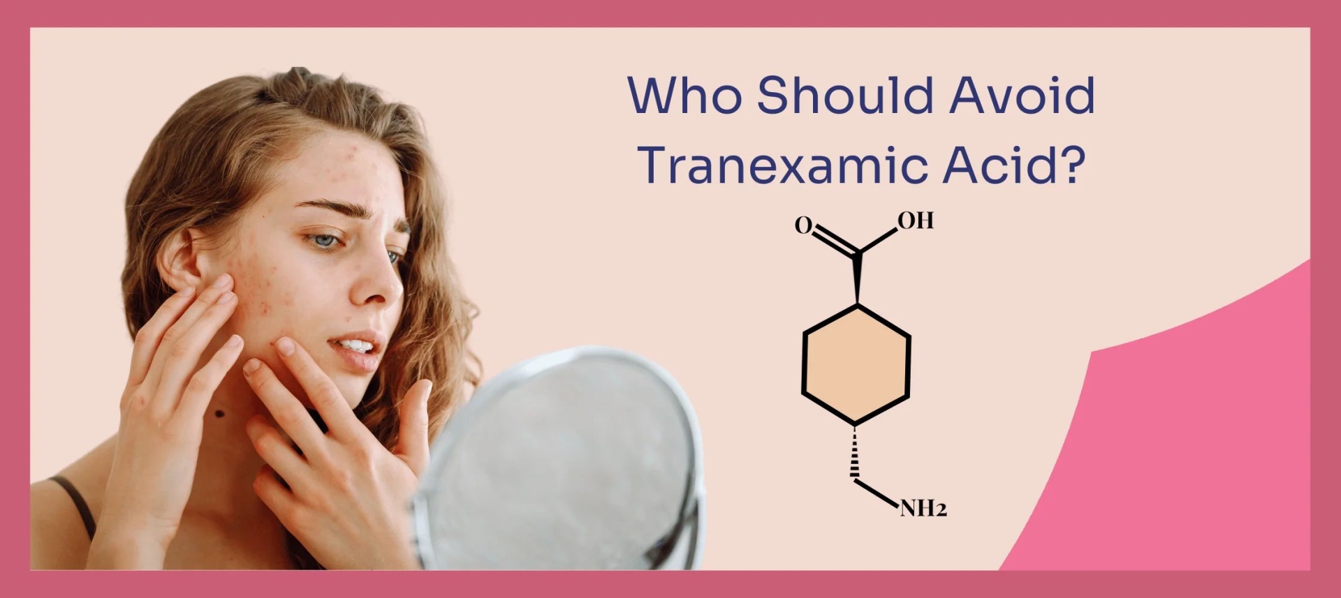 网红“氨甲环酸”被批准用于色斑治疗了吗？